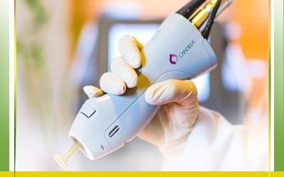 لیزر مونالیزا تاچ در ساری