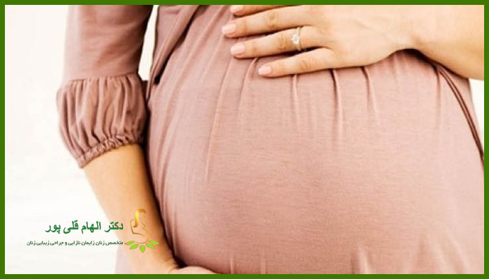 دلایل عدم توصیه انجام لابیاپلاستی در بارداری